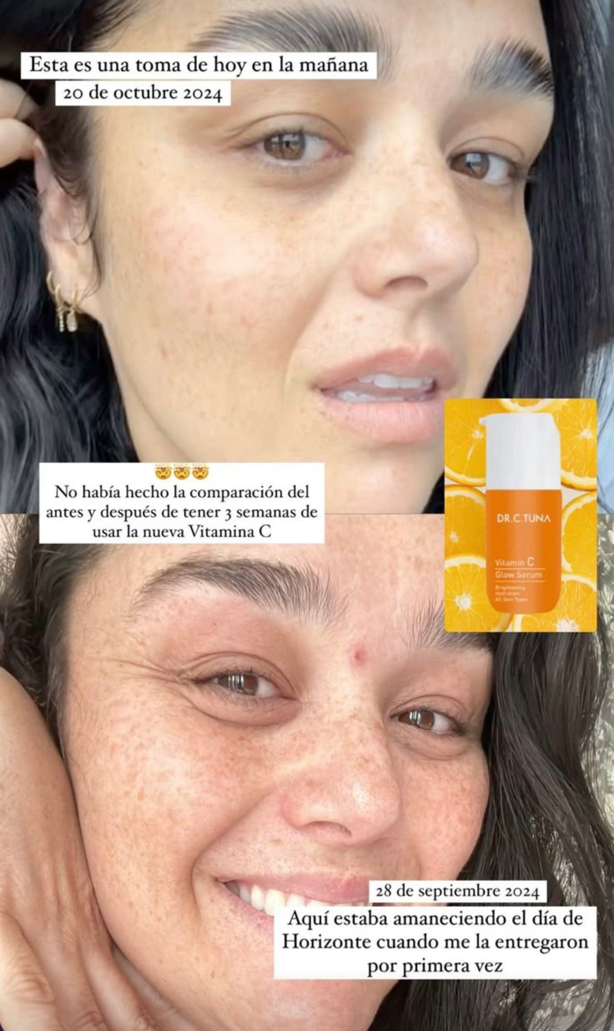 Serum Vitamina C (Línea Dermatológica)